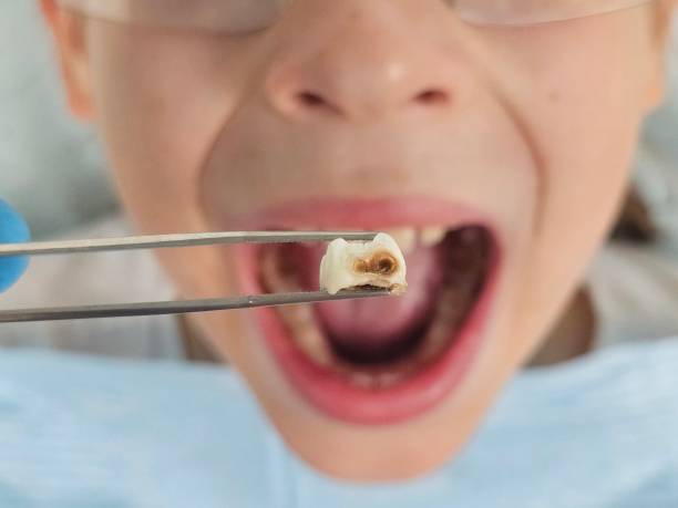 Best Emergency Gum Pain Relief  in Marion, OH